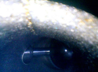 利用HIE系列內(nèi)窺鏡檢測(cè)到的某4s店發(fā)動(dòng)機(jī)進(jìn)氣道圖片