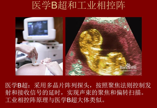 工業(yè)相控陣原理與醫(yī)學(xué)B超大體類似，醫(yī)學(xué)B超采用多晶片陣列探頭，按照聚焦法則控制發(fā)射和接收信號(hào)的延時(shí)，實(shí)現(xiàn)聲束的聚焦和偏轉(zhuǎn)掃描