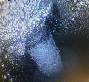 黑不溜秋的還有粉末狀，好惡心~  